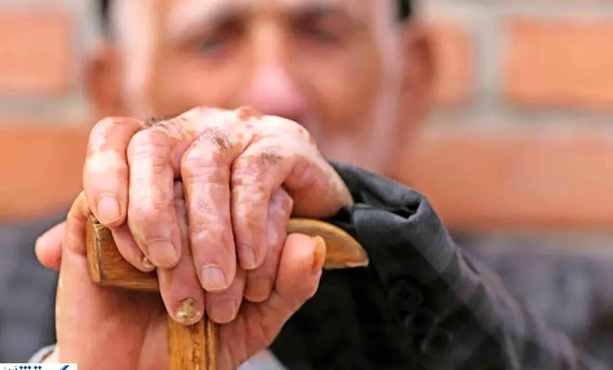 بازنشستگان بخوانند | درمان رایگان بدون بیمه تکمیلی در راه است؟ بازنشستگان بخوانند | درمان رایگان بدون بیمه تکمیلی در راه است؟