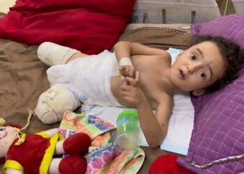 افزایش نگران کننده معلولیت‌های مادرزادی و جنگی در غزه