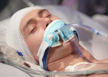 ضربه به سر ممکن است سلامت روده را مختل کند